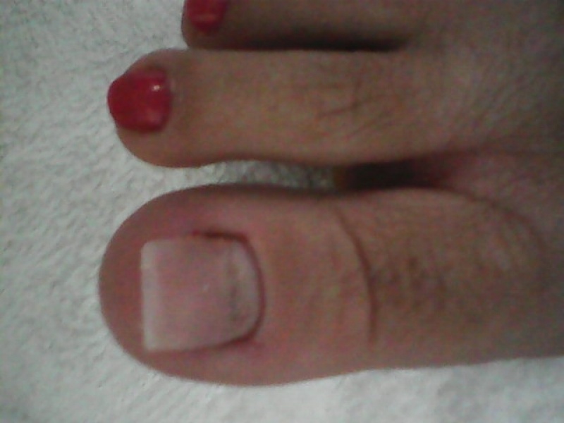 Clínica de Reconstrução de Unhas em Sp Sé - Reconstrução de Unhas em Gel