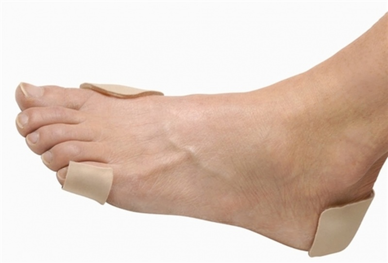 Clínica para Tratamento de Calos nos Pés Pacaembu - Tratamento de Calos entre Os Dedos