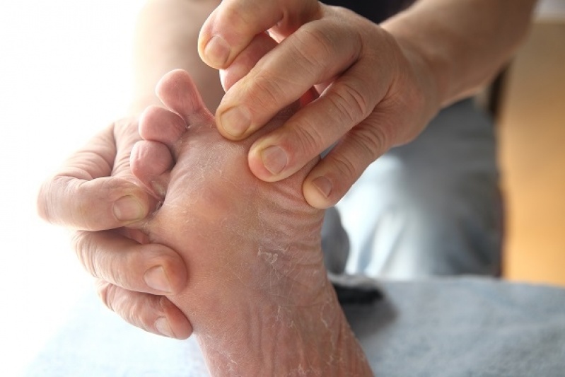 Onde Encontro Tratamento contra Descamação nos Pés Consolação - Massagem Relaxante nos Pés