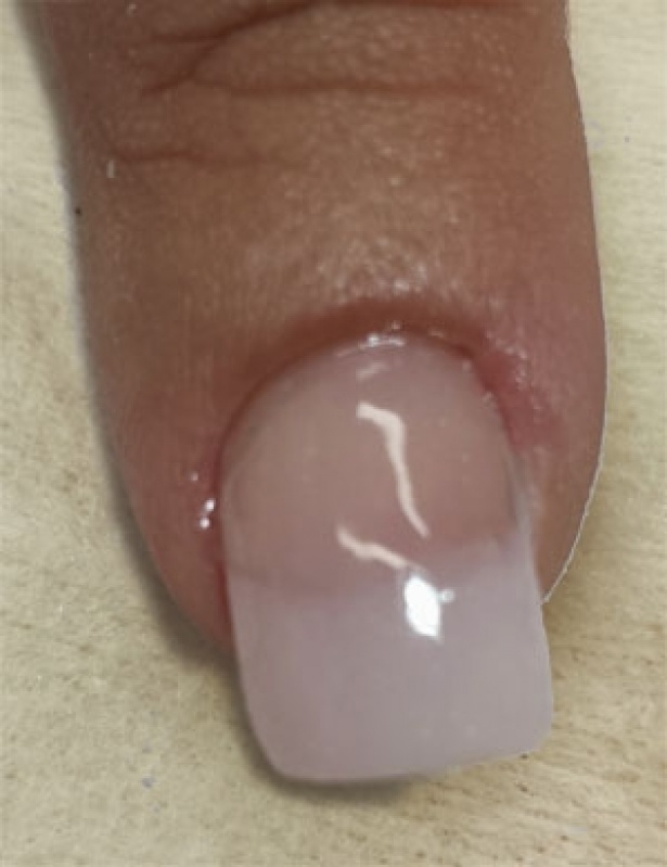 Orçamento de Reconstrução de Unhas de Gel Jaguaré - Reconstrução das Unhas