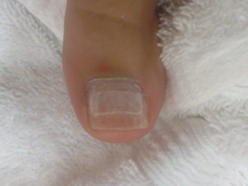 Orçamento de Reconstrução de Unhas em Gel Centro - Reconstrução de Unhas em Gel