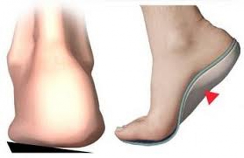Palmilhas e Sapatos Ortopédicos Preço Centro - Palmilhas para Tênis