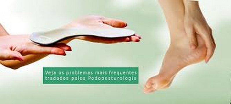 Palmilhas para Pisada Errada Preço Santa Efigênia - Palmilhas de Silicone