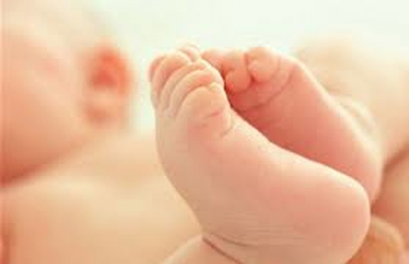 Podólogo para Bebê Consolação - Podólogo para Tratar Micose