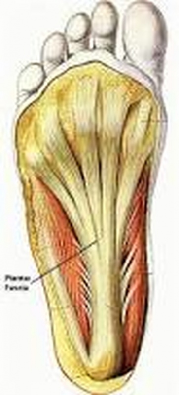 Podólogo para Fascite Plantar Água Branca - Podólogo para Fascite Plantar