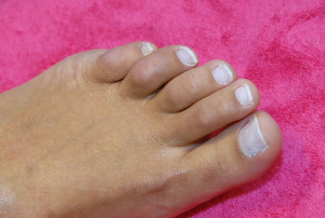 Reconstrução de Unhas de Gel Cambuci - Reconstrução de Unhas com Porcelana