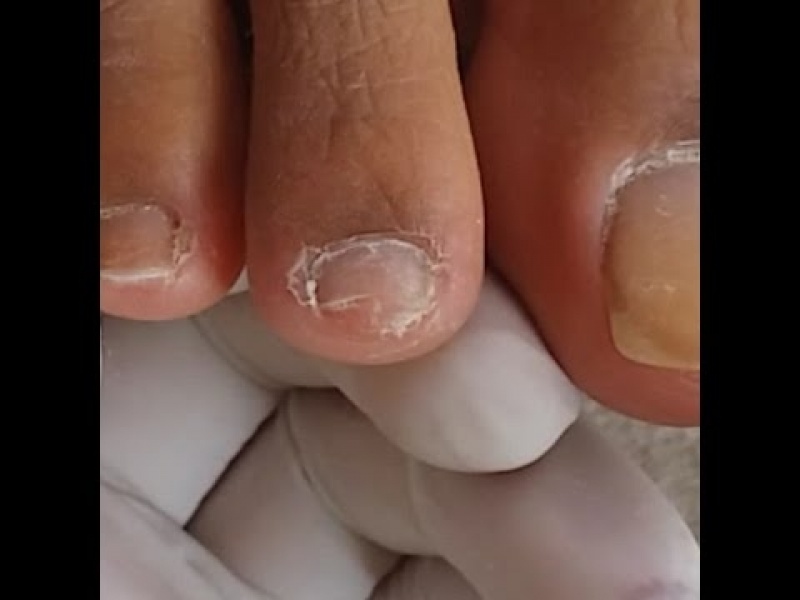 Reconstrução de Unhas Quebradas Preço Ipiranga - Reconstrução de Unhas com Gel