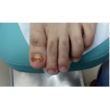 clínica de podologia para problemas nos pés Ibirapuera