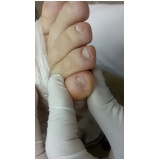 clínicas de podologia para problemas nos pés Morumbi