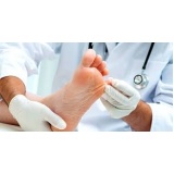 podólogo para tratamento contra rachaduras entre os dedos Glicério